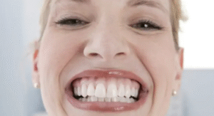dientes de arriba no tocan los de abajo